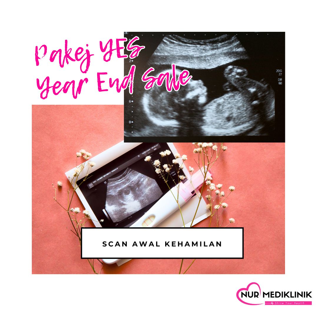 Klinik Scan Baby Di Tawau - Murah & Jelas